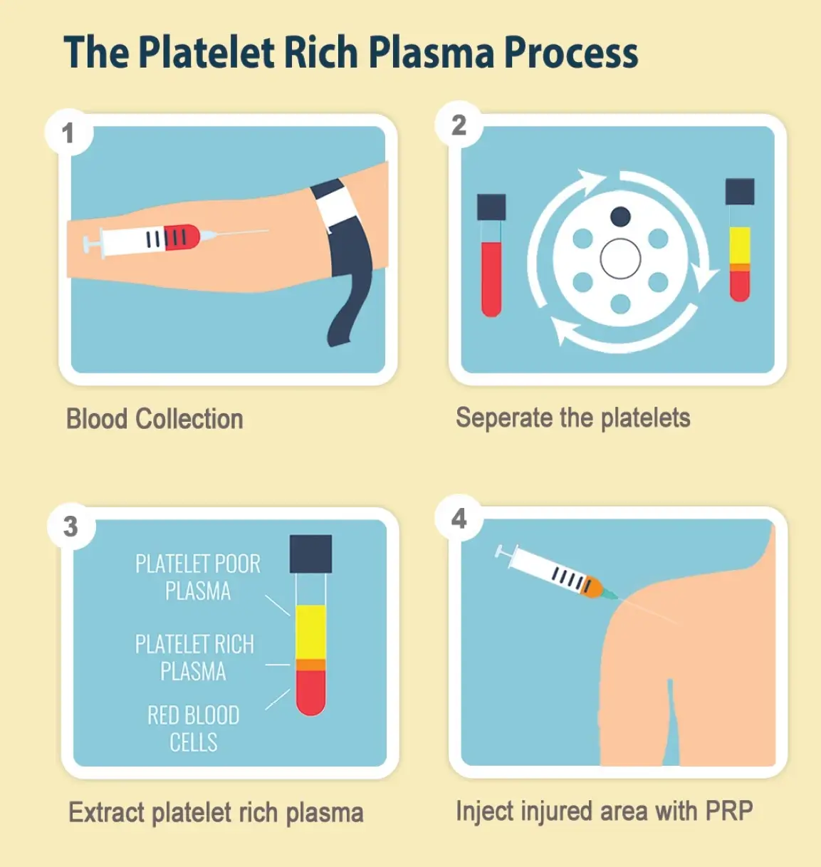 Platelet Rich Plasma Process