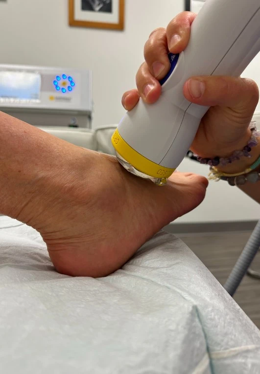 Softwave Therapy Foot Pain
