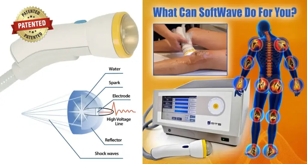 What Is SoftWave Technology, SoftWave side effects