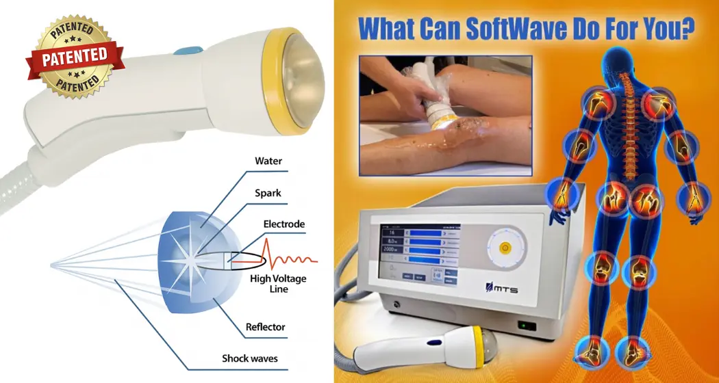 What Is SoftWave Technology SoftWave side effects