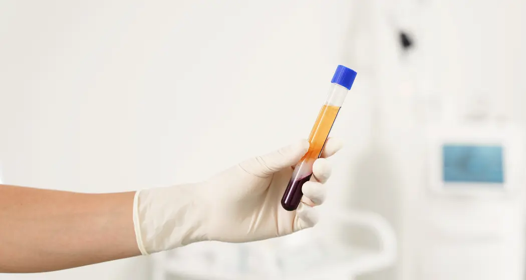 PRP Hair Regeneration The Ultimate Guide to Hair Renewal Waters Edge Medical Clinic PRP Hair Regeneration The Ultimate Guide to Hair Renewal