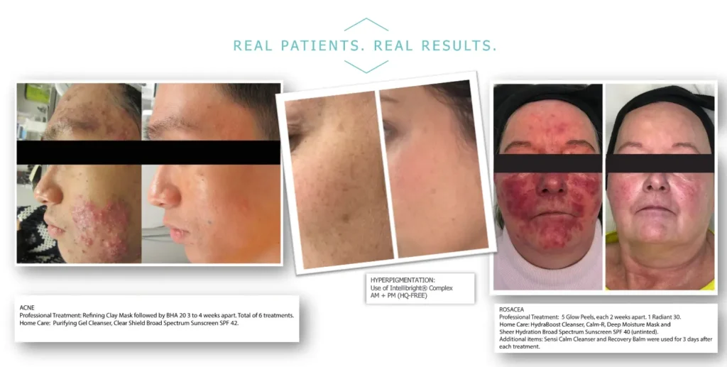 AllumierMD B+A 1 Waters Edge Medical Clinic AllumierMD B+A 1