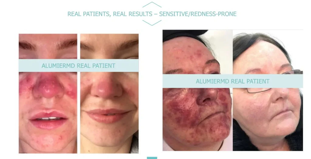 AllumiredMD B+A 2 Waters Edge Medical Clinic AllumiredMD B+A 2