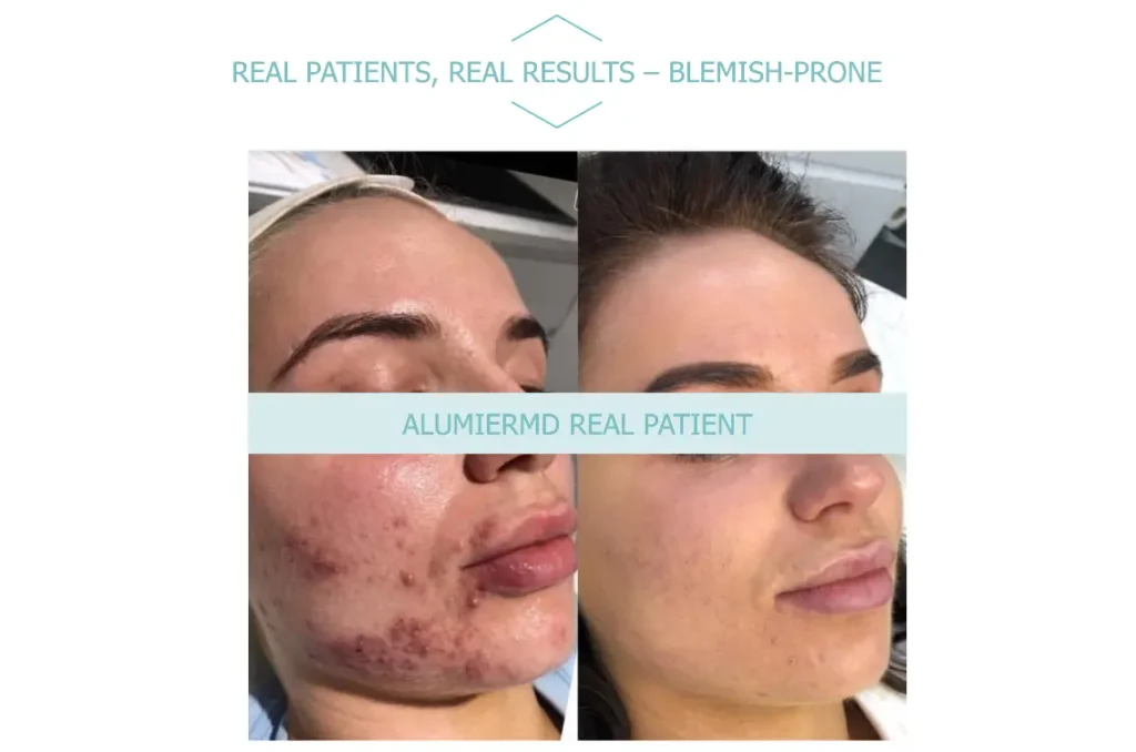 AllumierMD B+A 3 Waters Edge Medical Clinic AllumierMD B+A 3