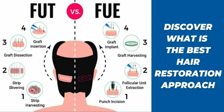 Best Hair Restoration Approach