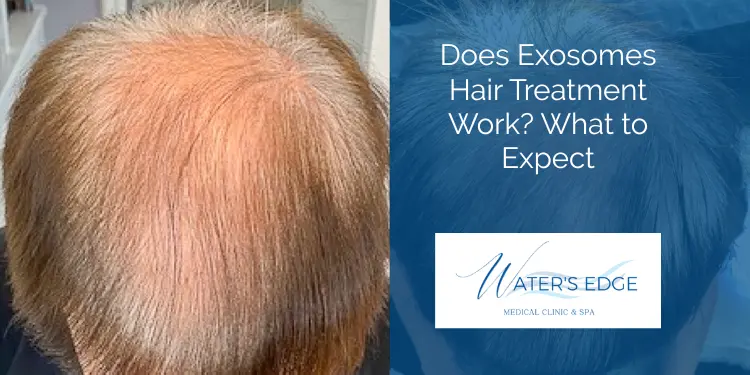 Does Exosomes Hair Treatment Work What to Expect Waters Edge Medical Clinic Does Exosomes Hair Treatment Work What to Expect