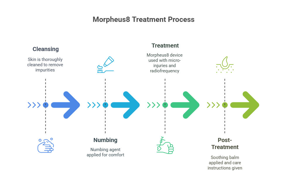 What to Expect During a Morpheus8 RF Microneedling Session Waters Edge Medical Clinic What to Expect During a Morpheus8 RF Microneedling Session