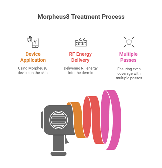 What to Expect During Face Rejuvenation Treatments with Morpheus8 Waters Edge Medical Clinic What to Expect During Face Rejuvenation Treatments with Morpheus8