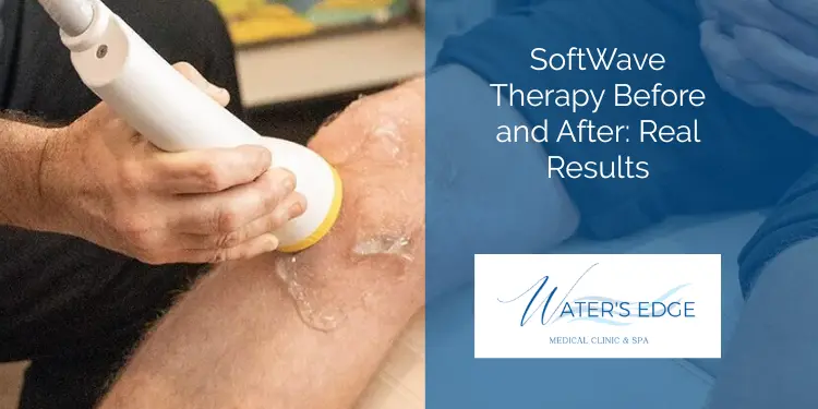 SoftWave Therapy Before and After Real Results Waters Edge Medical Clinic SoftWave Therapy Before and After Real Results