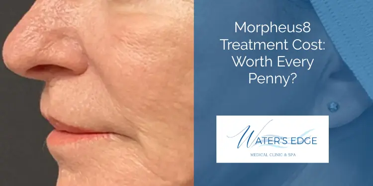 Morpheus8 Treatment Cost Worth Every Penny